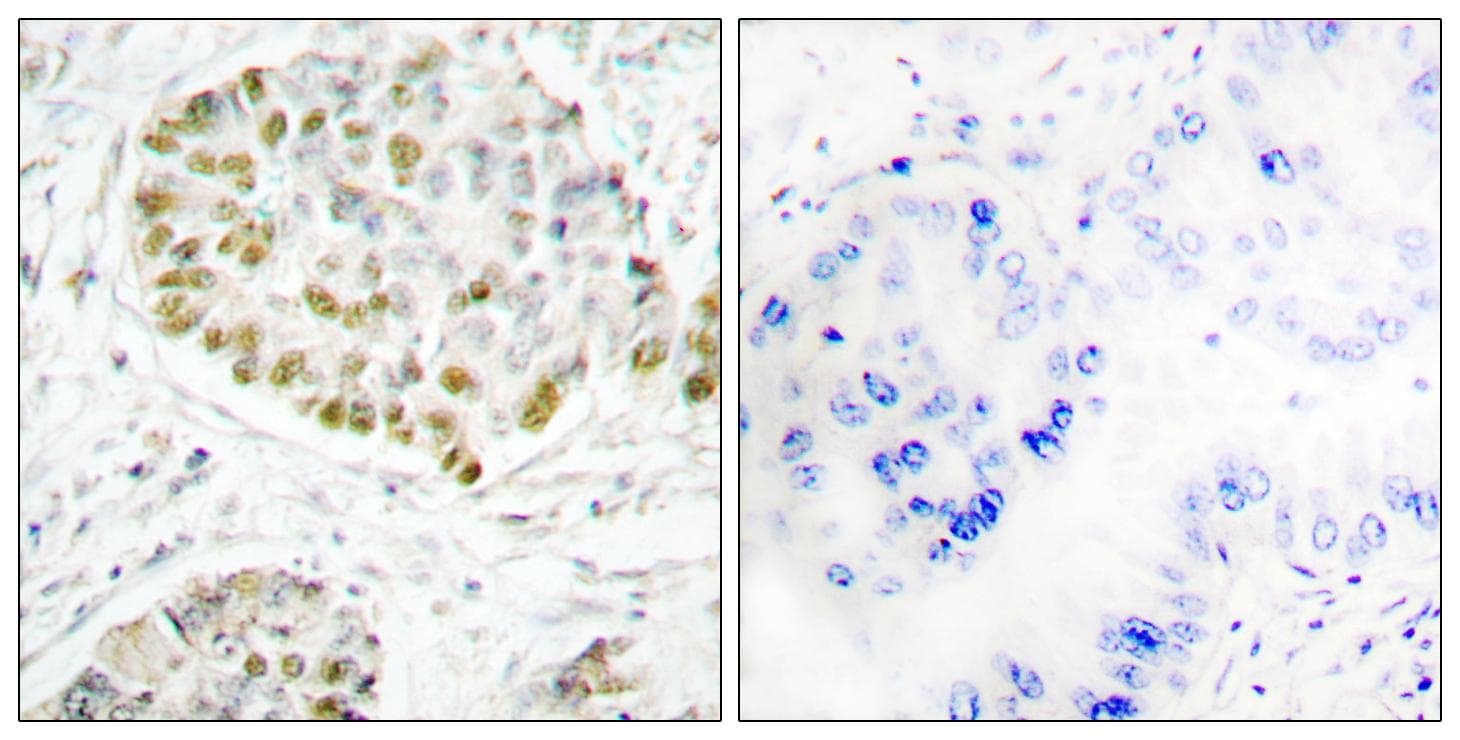 STAT5A Antibody