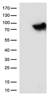 MTHFR Antibody (aa1-230, clone OTI3H5)