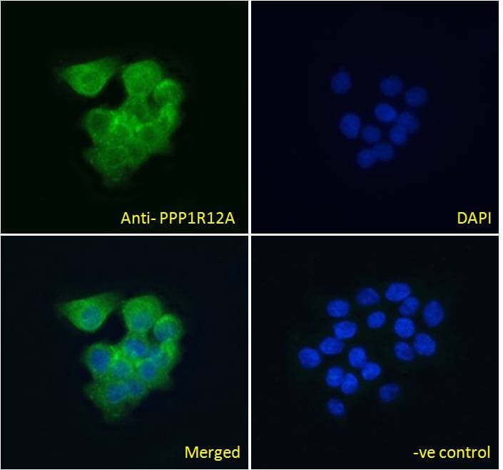 IHC-plus™ Polyclonal Goat anti-Human PPP1R12A / MYPT1 Antibody (IHC, IF)