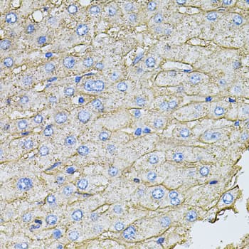 SLC2A2 / GLUT2 Antibody
