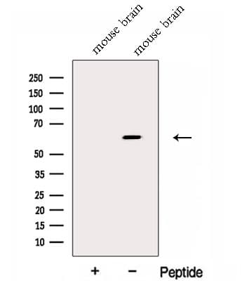FKTN / Fukutin Antibody