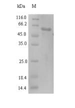 Newcastle Disease Virus SARS-CoV Nucleoprotein (Recombinant 6His, N-terminus)
