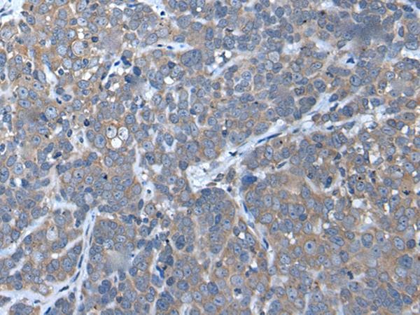 UBAC2 Antibody