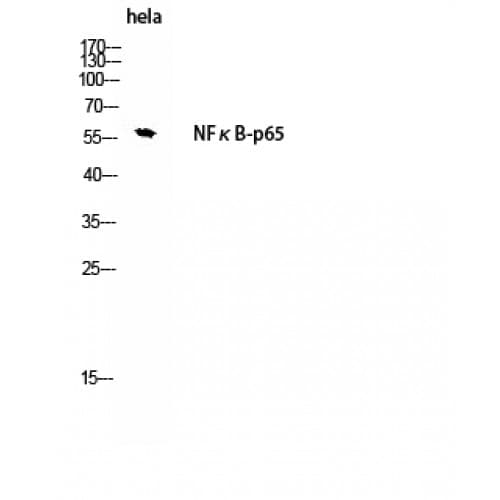 Polyclonal Rabbit anti-Human RELA / NFKB p65 Antibody (220-300 aa, IHC, WB)