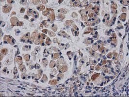 CDCP1 Antibody (clone OTI3B5)