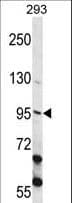 ECT2 Antibody (aa597-625)