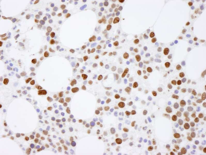 Polyclonal Rabbit anti-Human HIST1H4I Antibody (aa50-C-term, IHC)