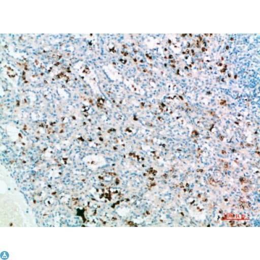 Polyclonal Rabbit anti-Human IL31 Antibody (WB)