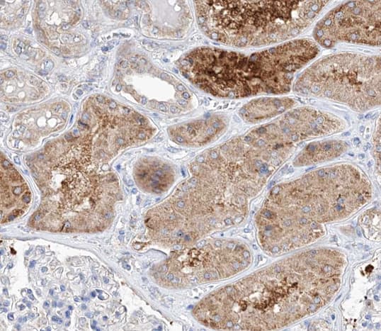 TRIM16 Antibody