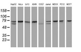 Monoclonal Mouse anti-Human CCDC93 Antibody (clone OTI2A4, WB)