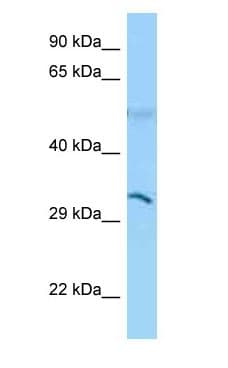 Polyclonal Rabbit anti-Human CD1B Antibody (aa64-113, WB)