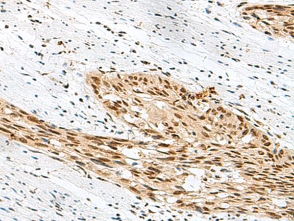 RBM12 Antibody