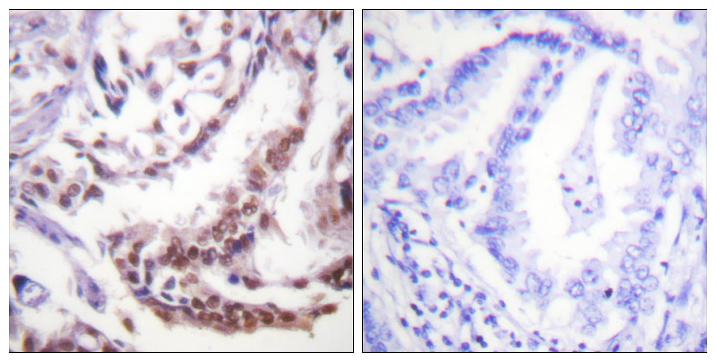 Histone H3 Antibody (Acetyl-Lys9)