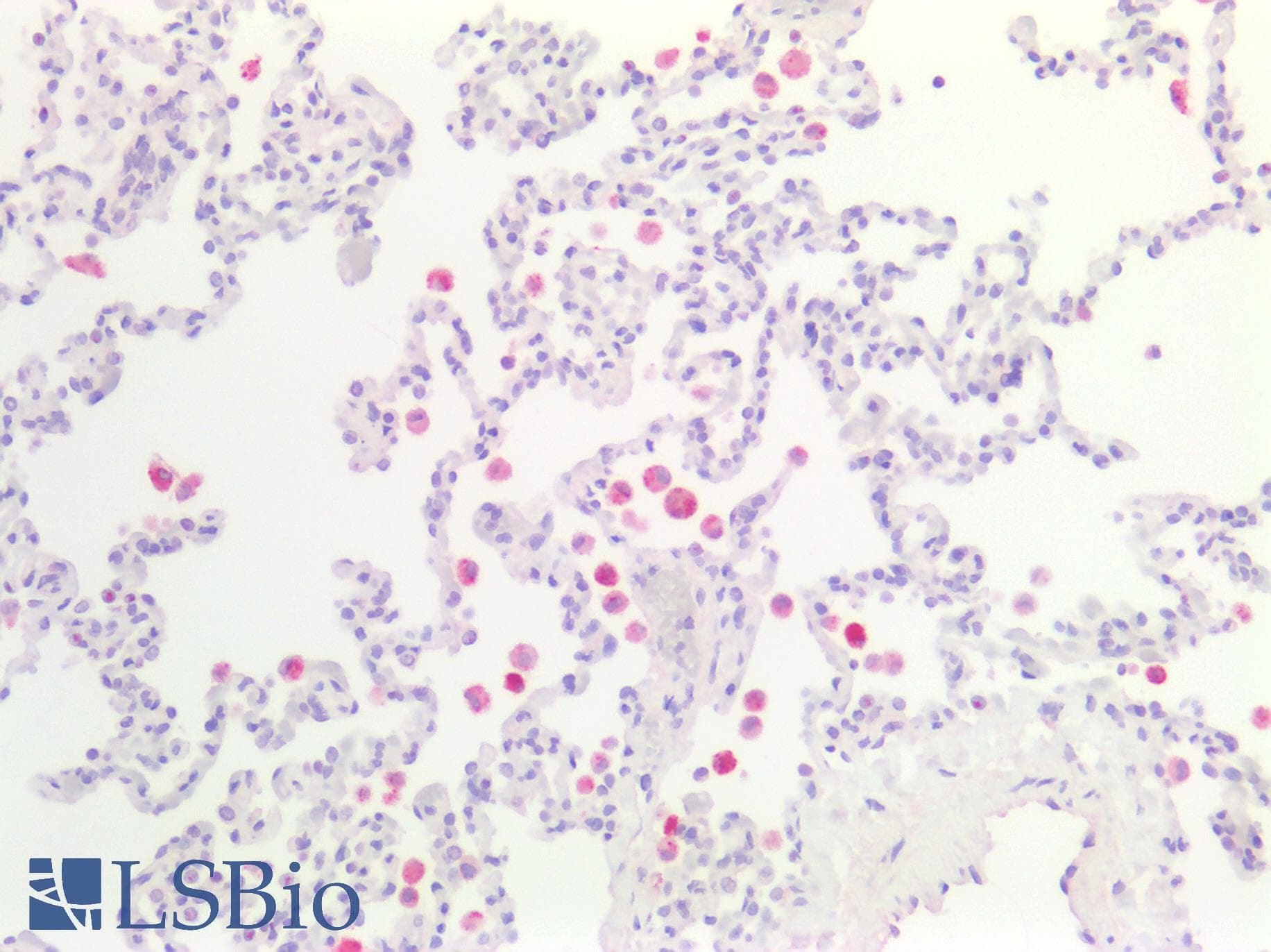 PathPlus™ ACP5 / TRAP Antibody (aa221-325, clone 5C5E7)