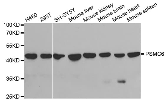 Polyclonal Rabbit anti-Human PSMC6 Antibody (IHC, WB)