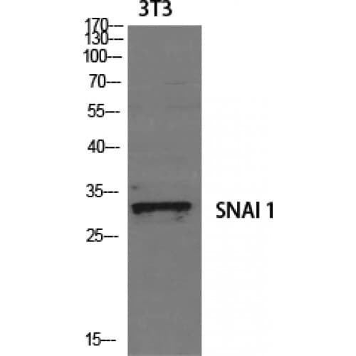 Polyclonal Rabbit anti-Human SNAI1 / SNAIL-1 Antibody (190-270 aa, IHC, IF, WB)