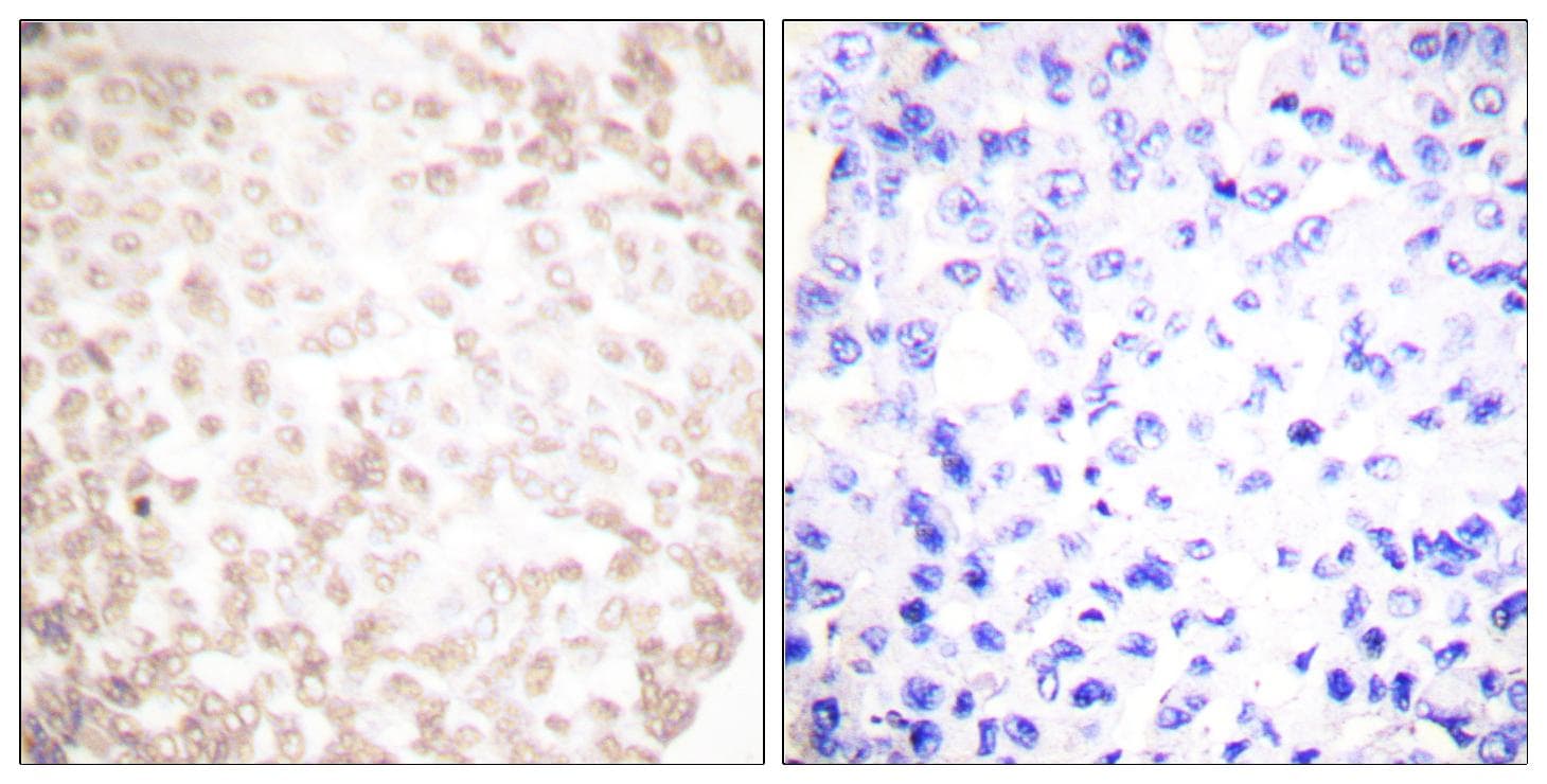 Polyclonal Rabbit anti-Human XRCC1 Antibody (IHC, WB)