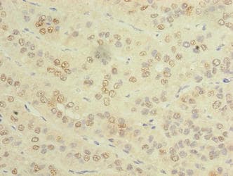 Polyclonal Rabbit anti-Human SPRYD5 Antibody (IHC, WB)