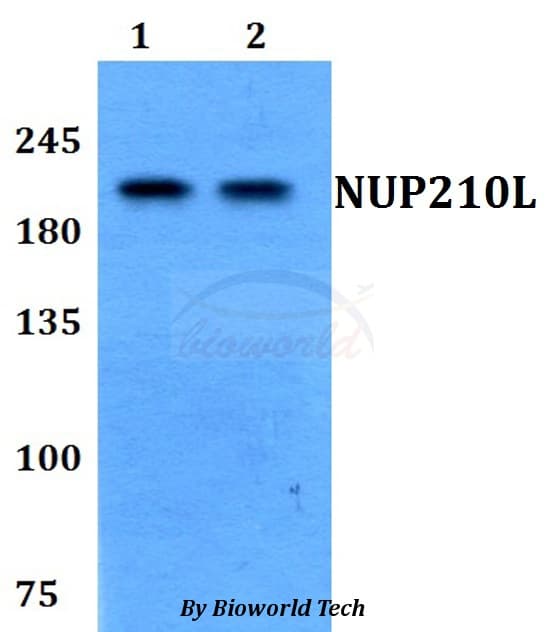Polyclonal Rabbit anti-Human NUP210L Antibody (WB)