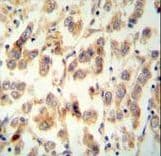 TTC16 Antibody (aa1-30)