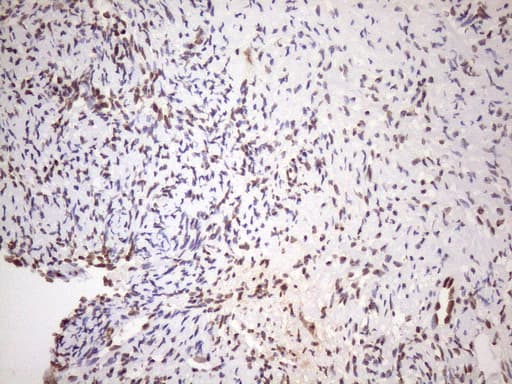 EXOSC1 / CSL4 Antibody (clone OTI4B7)