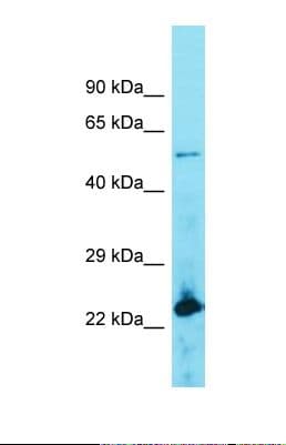 Polyclonal Rabbit anti-Human ACOT4 Antibody (aa297-345, WB)