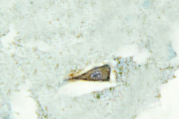 Polyclonal Rabbit anti-Human HTR4 / 5-HT4 Receptor Antibody (Asp47, IHC, IF, WB)
