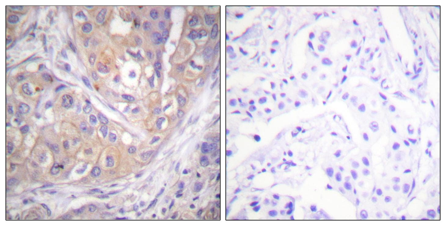 Polyclonal Rabbit anti-Human p56lck / LCK Antibody (phospho-Tyr505, IHC, WB)