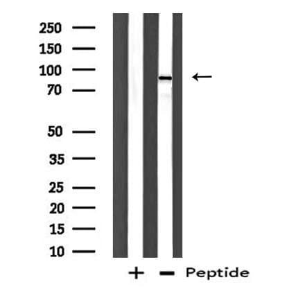DP97 / DDX54 Antibody