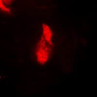 RPS6KA5 / MSK1 Antibody (Internal)