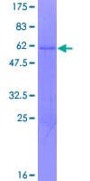 Human HZF16 / ZNF124 Protein (Recombinant GST)