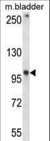 Polyclonal Rabbit anti-Human GRID1 Antibody (aa846-875, IHC, WB)