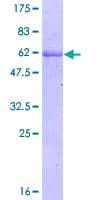 Human MXI1 / MAD2 Protein (Recombinant GST)