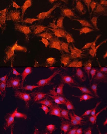 Polyclonal Rabbit anti-Human ABCB10 Antibody (IF)