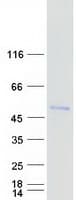 Human FOXD4L1 / FOXD5 Protein (Recombinant Myc-DDK (Flag))