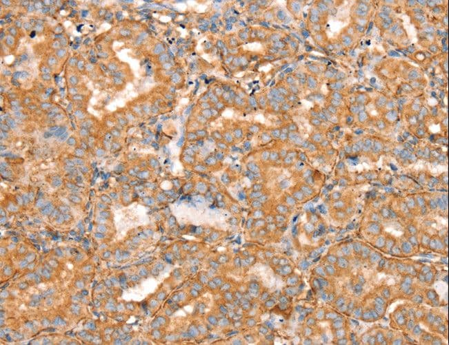 Polyclonal Rabbit anti-Human SLC16A8 Antibody (IHC, WB)