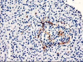 TP73-AS1 / KIAA0495 Antibody (clone OTI2B9)