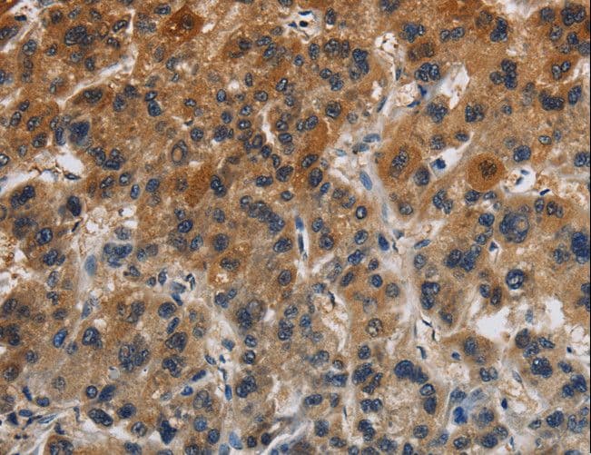 CLDN8 / Claudin 8 Antibody