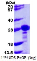 Human CBX1 / HP1 Beta Protein (Recombinant His)
