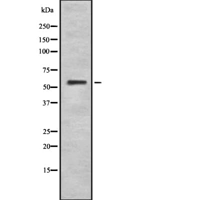Polyclonal Rabbit anti-Human CYP4F2 Antibody (WB)