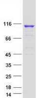 Human OGDHL Protein (Recombinant Myc-DDK (Flag))
