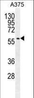 SPDYE3 Antibody (aa455-483)