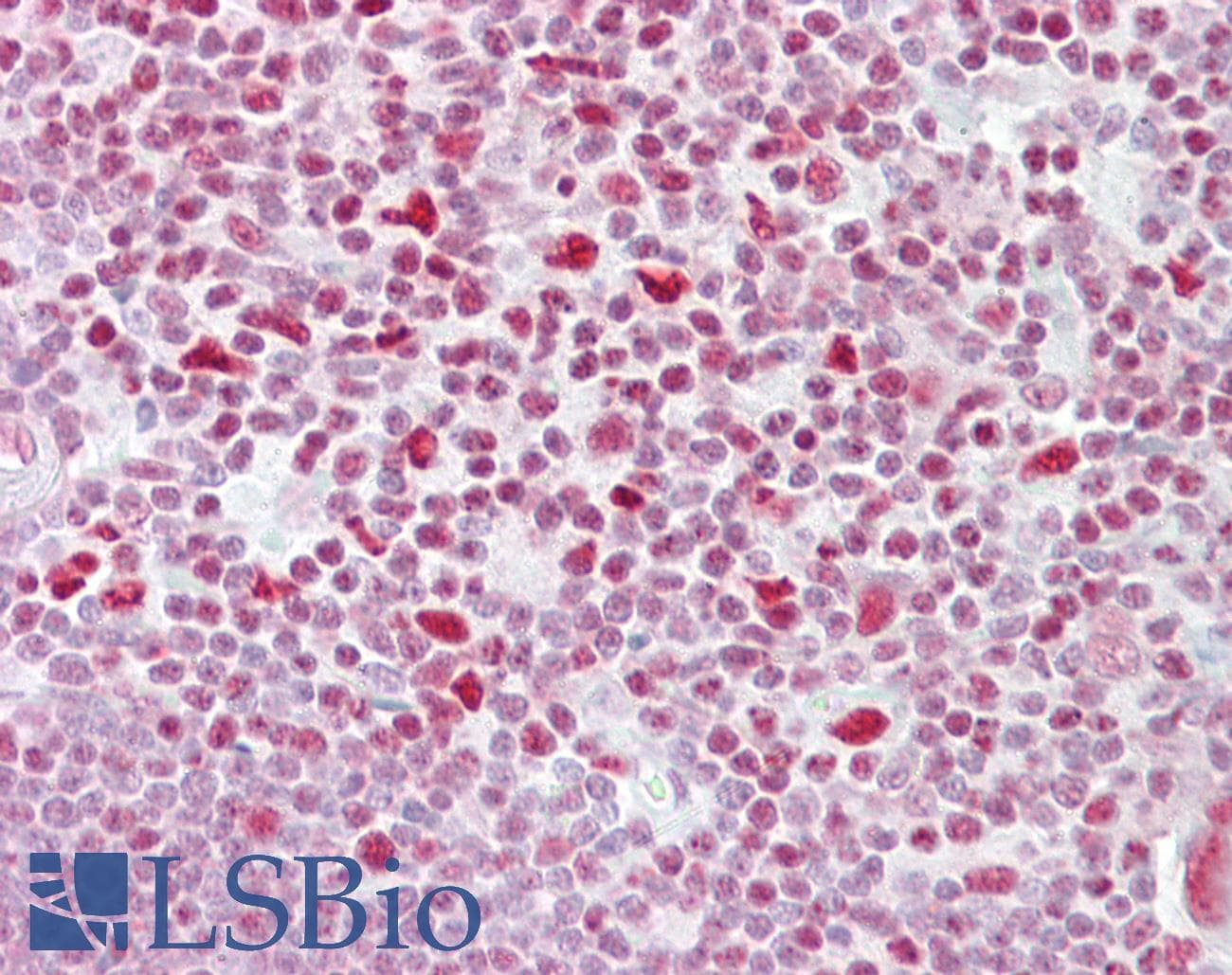 NFAT4 / NFATC3 Antibody (aa324-373)