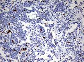 TOP2A / Topoisomerase II Alpha Antibody (aa1100-1531, clone OTI1D5)