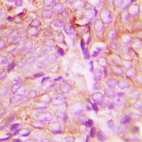 PRKCD / PKC-Delta Antibody (phospho-Tyr313)
