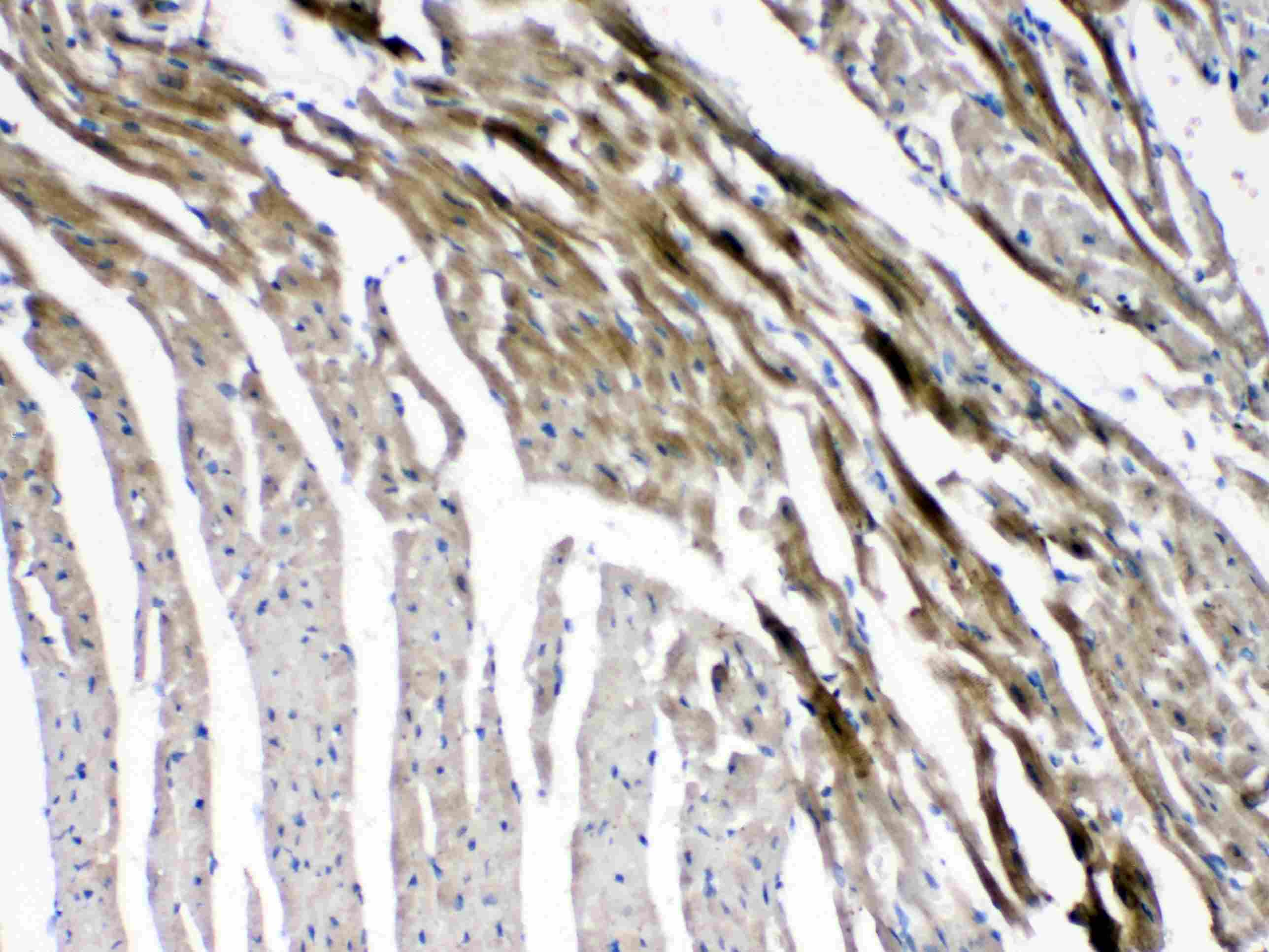 Polyclonal Rabbit anti-Human GJC1 / CX45 / Connexin 45 Antibody (IHC, WB)