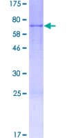 Human ACTR3B / ARP4 Protein (Recombinant GST)