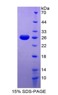 Mouse GATA2 Protein (Recombinant His-T7)