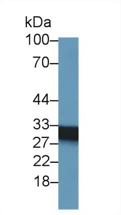 SDHB Antibody (aa97-282, PE)