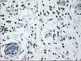 NRBP1 / NRBP Antibody (clone OTI6C11)